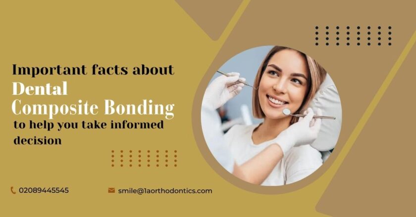 Important Facts About Dental Composite Bonding to Help You Take Informed Decision