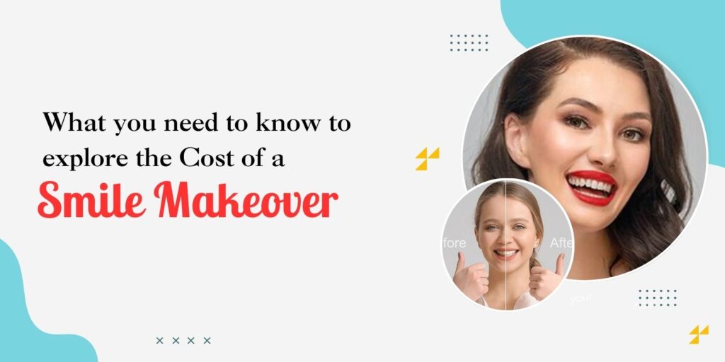 What You Need to Know to Explore the Cost of a Smile Makeover